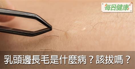 女生奶頭有毛|乳頭邊長了毛，是什麼病？該不該拔？讓名醫一次解釋給您聽｜每